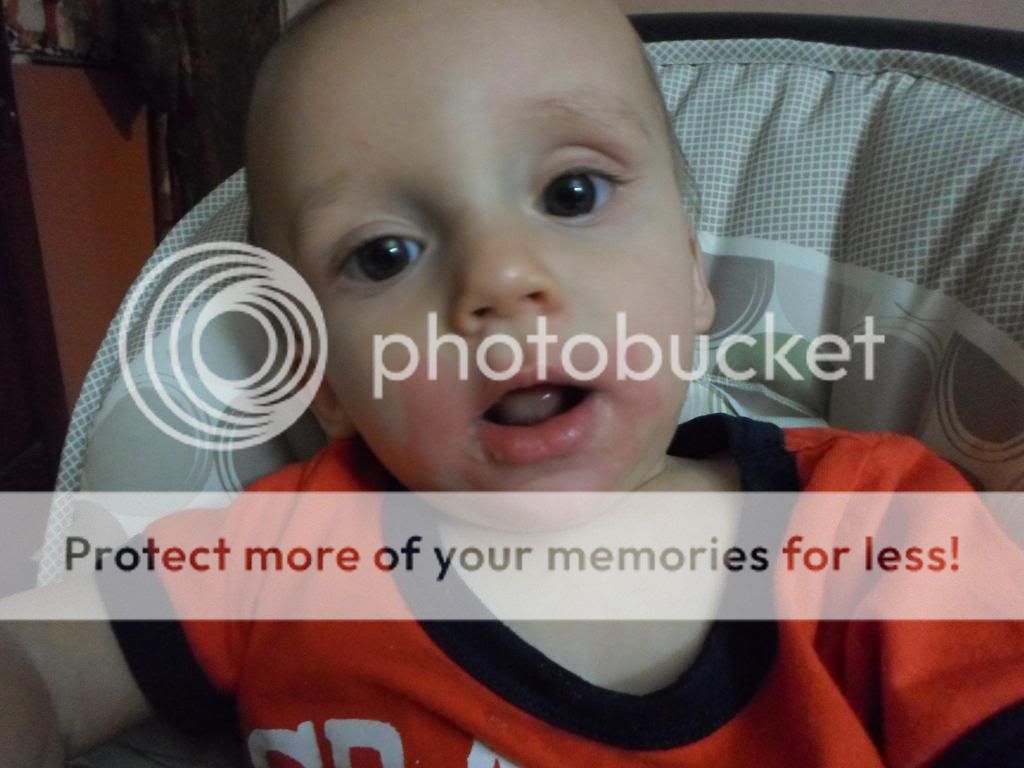 Cinnamon Allergy? (Pic Included) BabyCenter